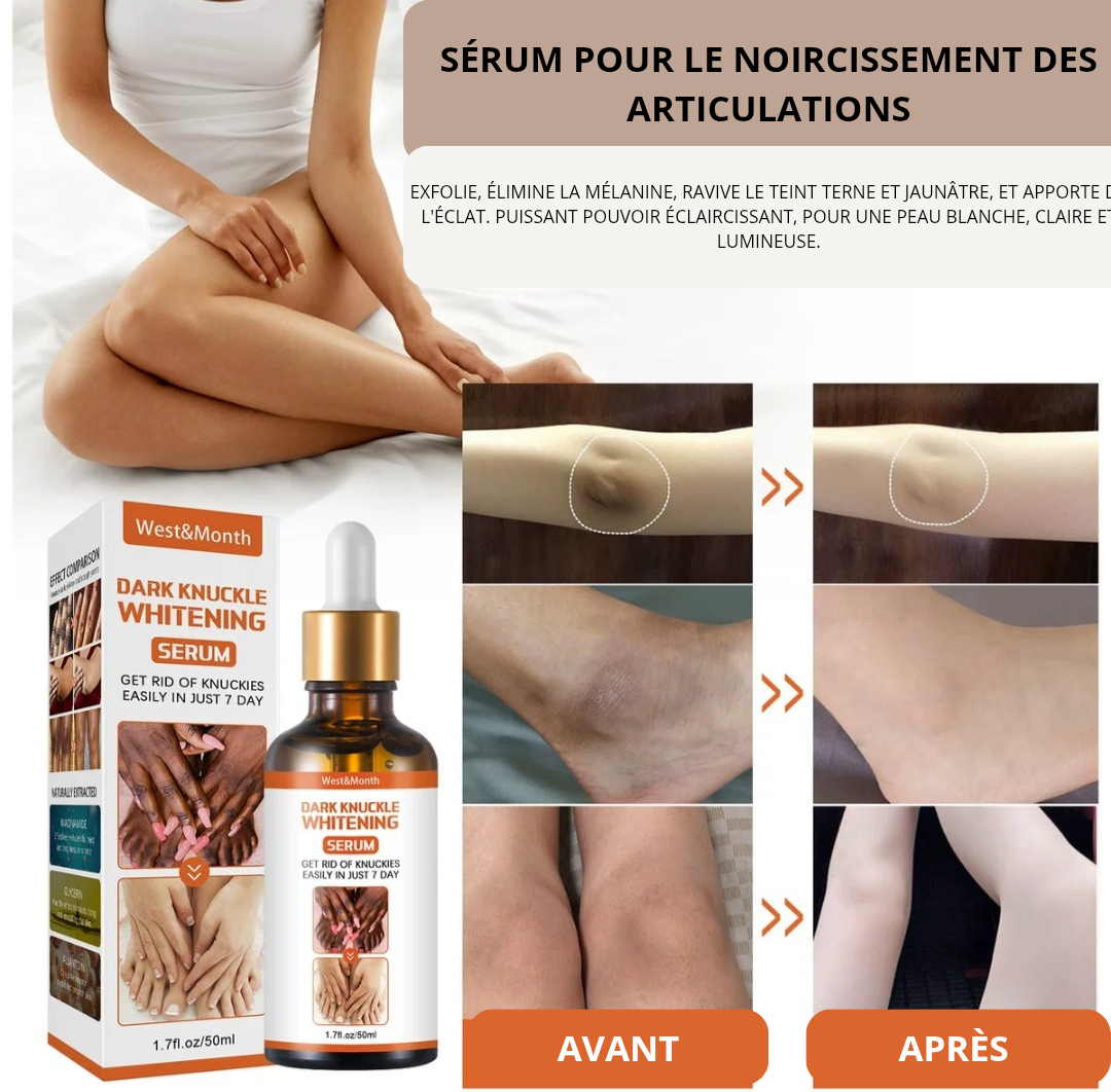 Produits de blanchiment des articulations foncées™