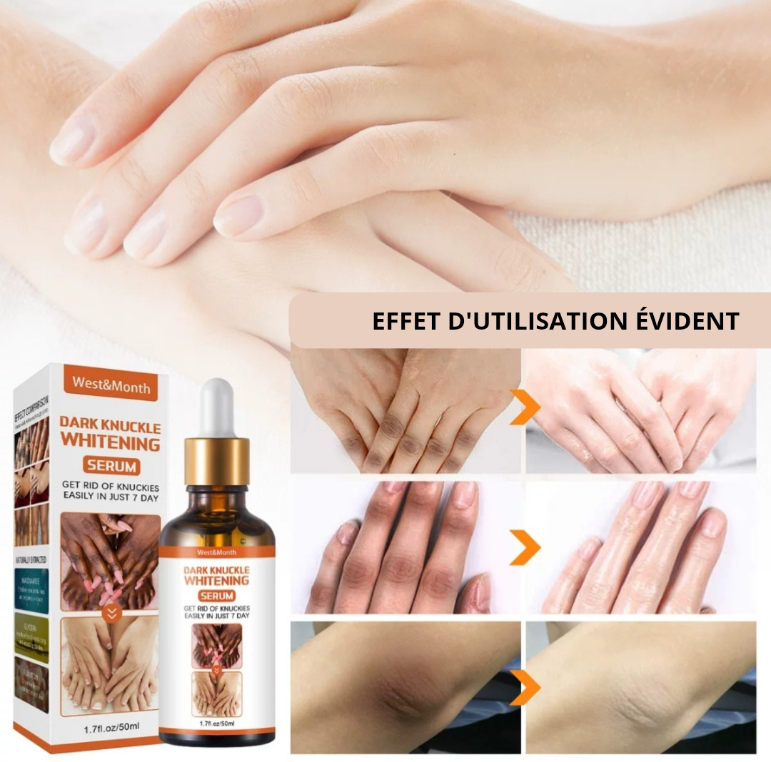 Produits de blanchiment des articulations foncées™