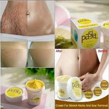 Pastel produit contre les vergetures